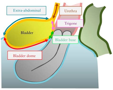 Bladder Dome Anatomy