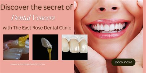 Discover the Secret of Veneer: Pros and Cons