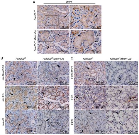 Loss Of Fam20c Causes Defects In The Acinar And Duct Structure Of