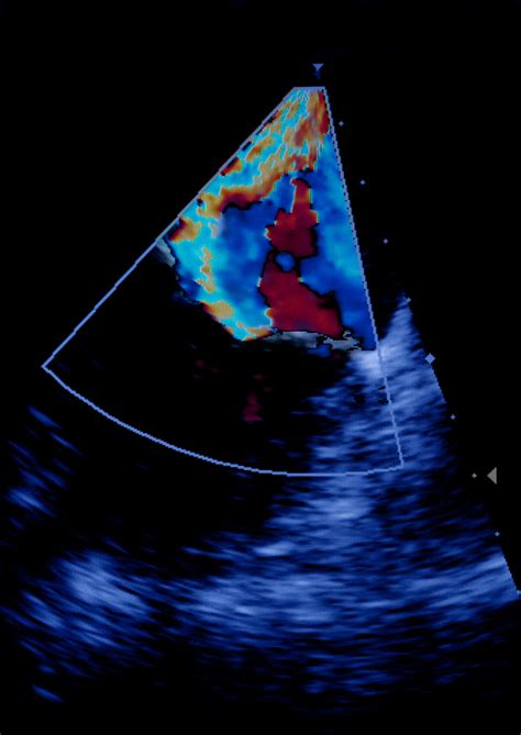 Types Of Ultrasounds Two Views