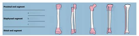 Ao Ota Fracture Classification System Diagram Quizlet