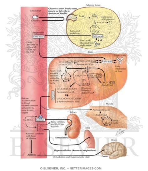 Diabetic Ketoacidosis