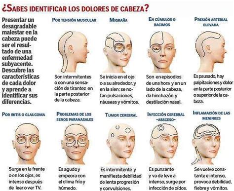 Cuadro comparativo Semiología de las CEFALEAS Medicina mnemotecnias