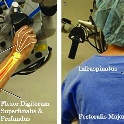 Ergonomics Based Positioning Of Operating Handle Of The Surgical