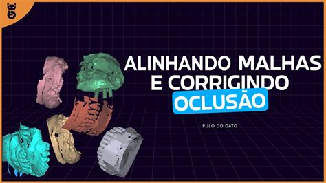 EXOCAD Alinhar arquivos 3D e correção da oclusão aumento de DVO no