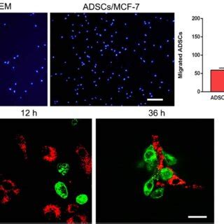 (a) Transwell migration assay, Migration of ADSCs treated with DMEM and... | Download Scientific ...