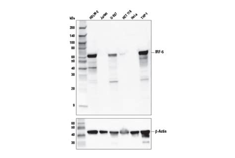 IRF-5 (E7F9W) Rabbit mAb | Cell Signaling Technology