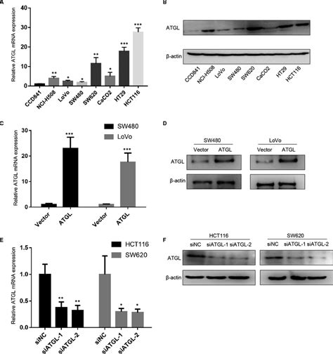 Detection Of ATGL Expression In CRC Cell Lines A B QRTPCR Analysis