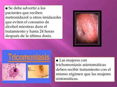 Tratamiento De Tricomoniasis