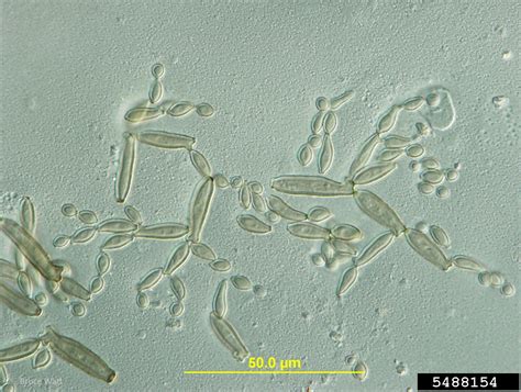 Cladosporium Fungi Genus Cladosporium