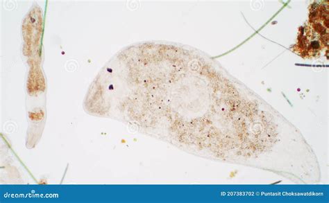 Planaria Flatworm Under the Microscope View. Stock Footage - Video of ...