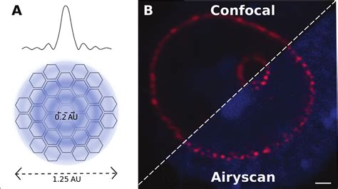 Pixel reassignment by Airyscanning. (A) Confocal pinhole is substituted ...