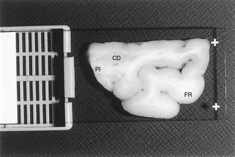 —block No 1—section Through The Frontal Pole Cut 1 Figure 2 The Download Scientific