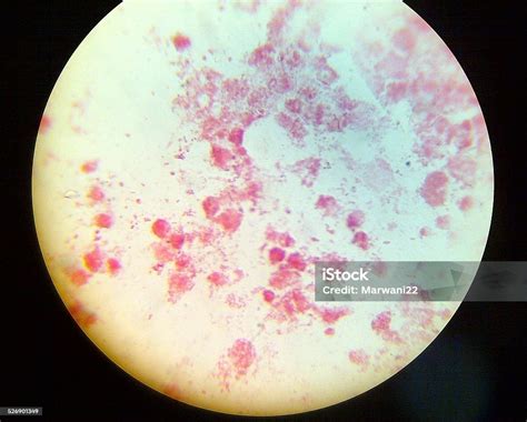 Neisseria Gonorrhoeae Microscope