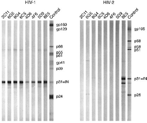 Western Blot Analysis Of Hiv And Hiv Virions With Selected