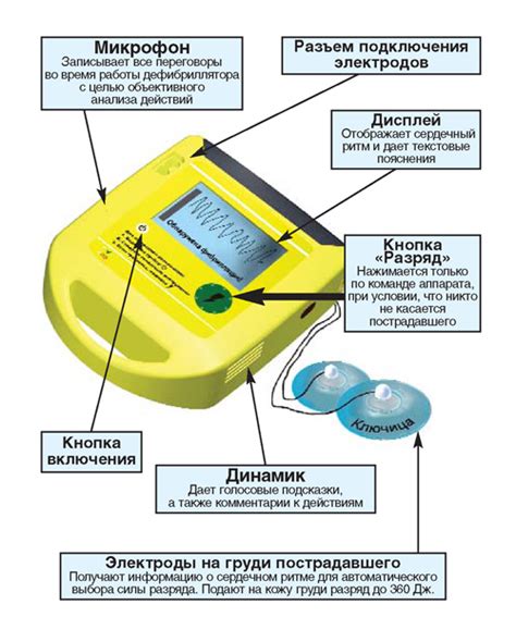 ГАЛО — Дефибриллятор