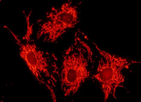 Bovine Pulmonary Artery Cell Mitochondria Nikons MicroscopyU