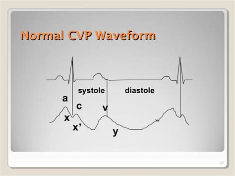 Cvp central venous pressure monitoring