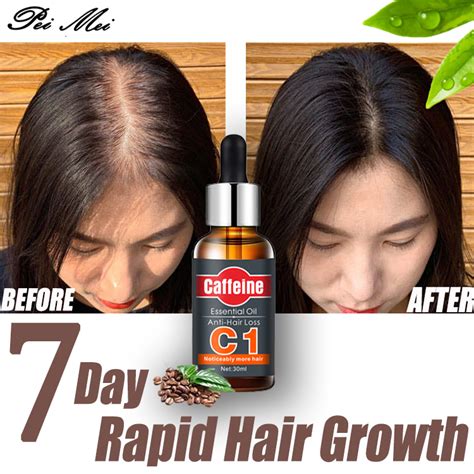 Caffenine Anti Hair Loss Essential Oil Hair Care 30ml Rk Essentials