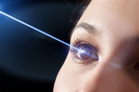 Cum Func Ioneaz Chirurgia Ocular Cu Laser Lasik Beneficiile I