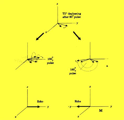 Direction Of Inversion Pulse Questions And Answers In Mri