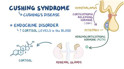 Cushing's Syndrome Pathophysiology