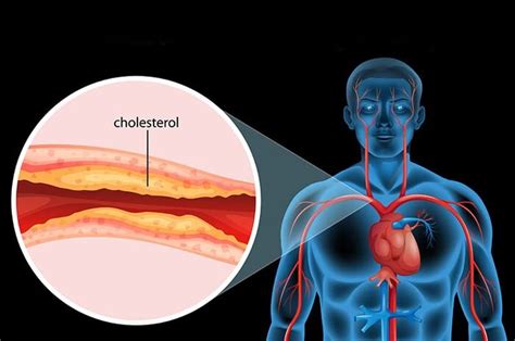 Perawathomecare Periksa Gula Darah Asam Urat Dan Kolesterol