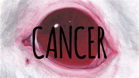 Cancer A Trap With A Fancy Title Lowballed For Years July