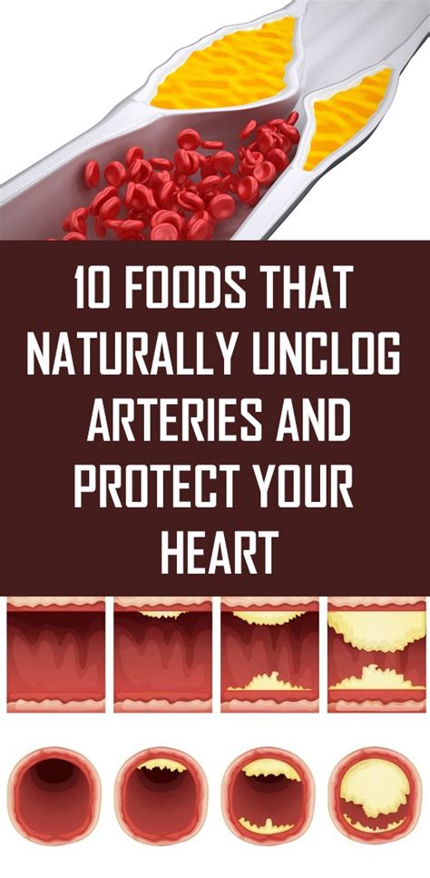 Here Are 10 Foods That Naturally Unclog Arteries And Protect Your Heart