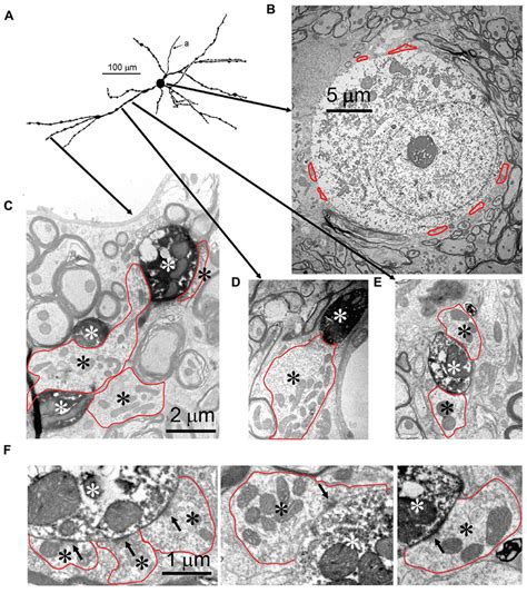 Synaptic Inputs To An Mlntb Cell A Camera Lucida Drawing Of The