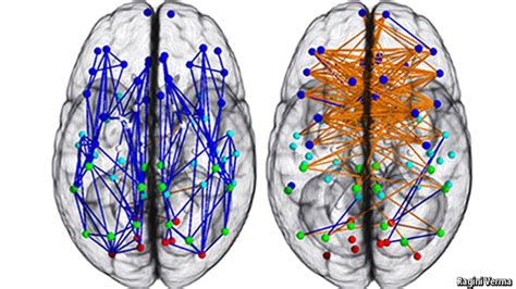 Vive La Différence Sex And Brains