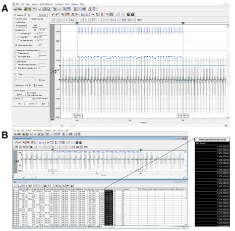 RR Interval Calculation. (A) Example of RR interval analysis with ...