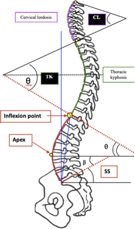 Quantifying The Spinal Lordosis Ratio Unique To The Type Of Spinal