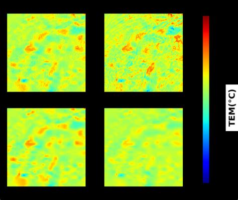 The Spatial Bias Distribution Between Hrcldas And Each Model In The