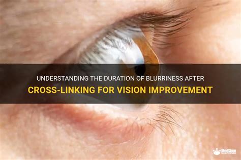 Understanding The Duration Of Blurriness After Cross Linking For Vision