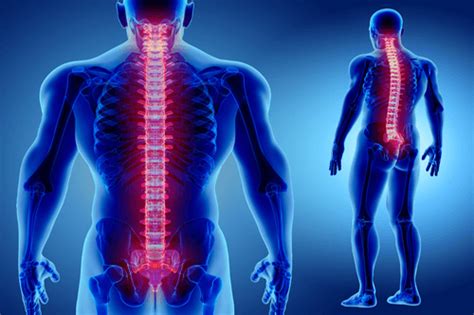 Transverse Myelitis Symptoms Causes Diagnosis And Treatment Factdr