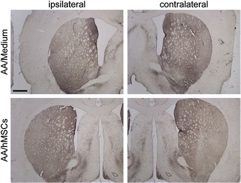 Neuroprotective Effects Of Human Umbilical Cord Mesenchymal Stromal