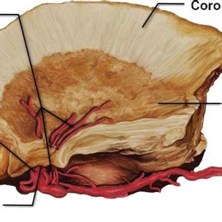 Illustration representing a superior view of lateral lenticulostriate ...