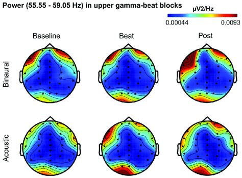 Scalp Distribution Of Eeg Spectral Power During Blocks With