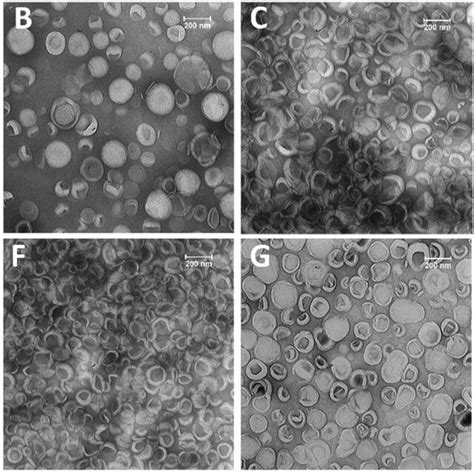 Transmission Electron Microscopy Tem Images Of The Negatively Stained