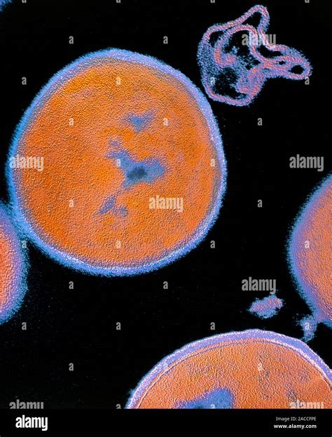 False Colour Transmission Electron Micrograph Tem Of Bacteria