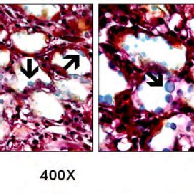 Histological Images Goldner Trichrome Stain Of The Distracted Gap Of