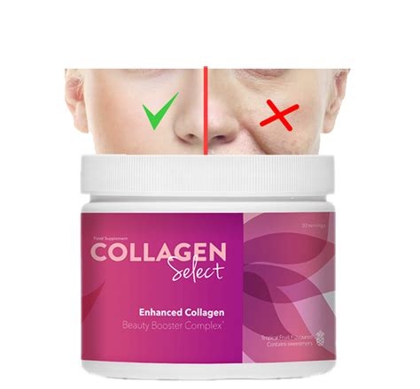 Collagen Select Is A Food Supplement Aimed At Women Who Want To Maintain Beautiful Firm And