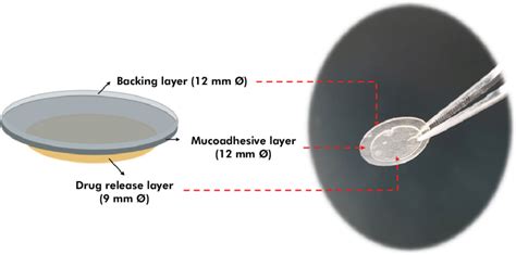 Mucoadhesive Patches Used In The Clinical Evaluation Of The Efficacy Of Download Scientific