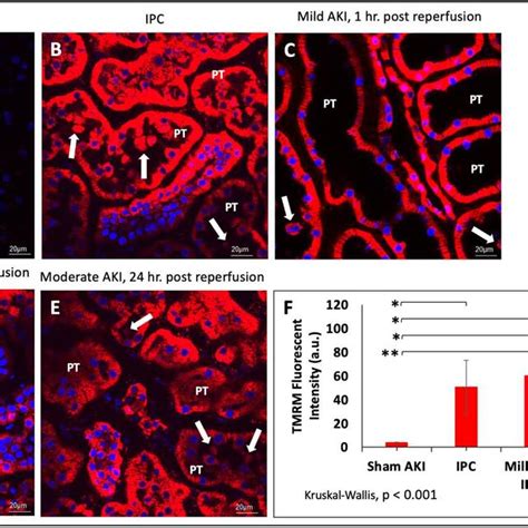 Mitochondrial Membrane Potential Activity Was Examined In Nephron Download Scientific Diagram