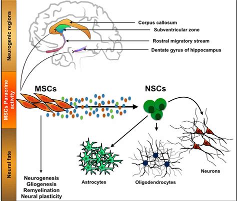 Parkinson Disease Treatment With Stem Cells Swiss Medica