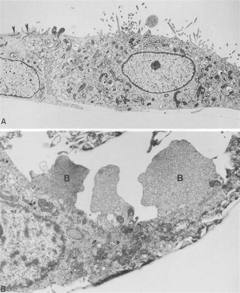 A Electron Micro Graph Of A Normal Llc Pk Cell Note Tight Junctions