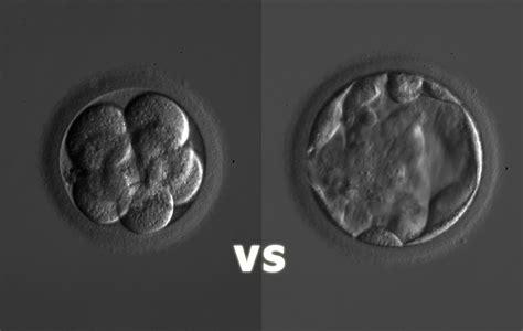 Busting Myths About Embryo Transfer What Every Ivf Patient Needs To