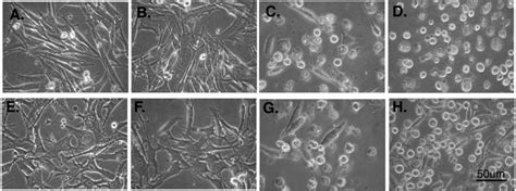 Morphologic Features Of Ocm 1 Ad And Ocm 8 Eh Cells 24 Hours