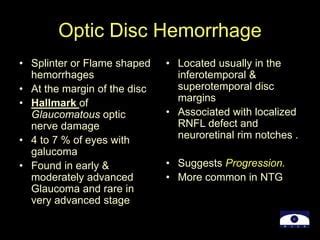 22 Optic Disc Evaluation IN Glaucoma Ppt